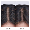 Moroccanoil-Oil-No-More-Scalp-Treatment-45m-before-after