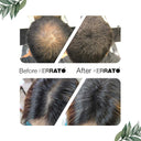 Kerrato Hair Thickening Fibers
