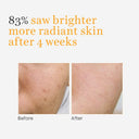 Buy O3+ Skin SoLutions Vitamin C Serum Glow With Glycolic Acid (30ml) Online in India